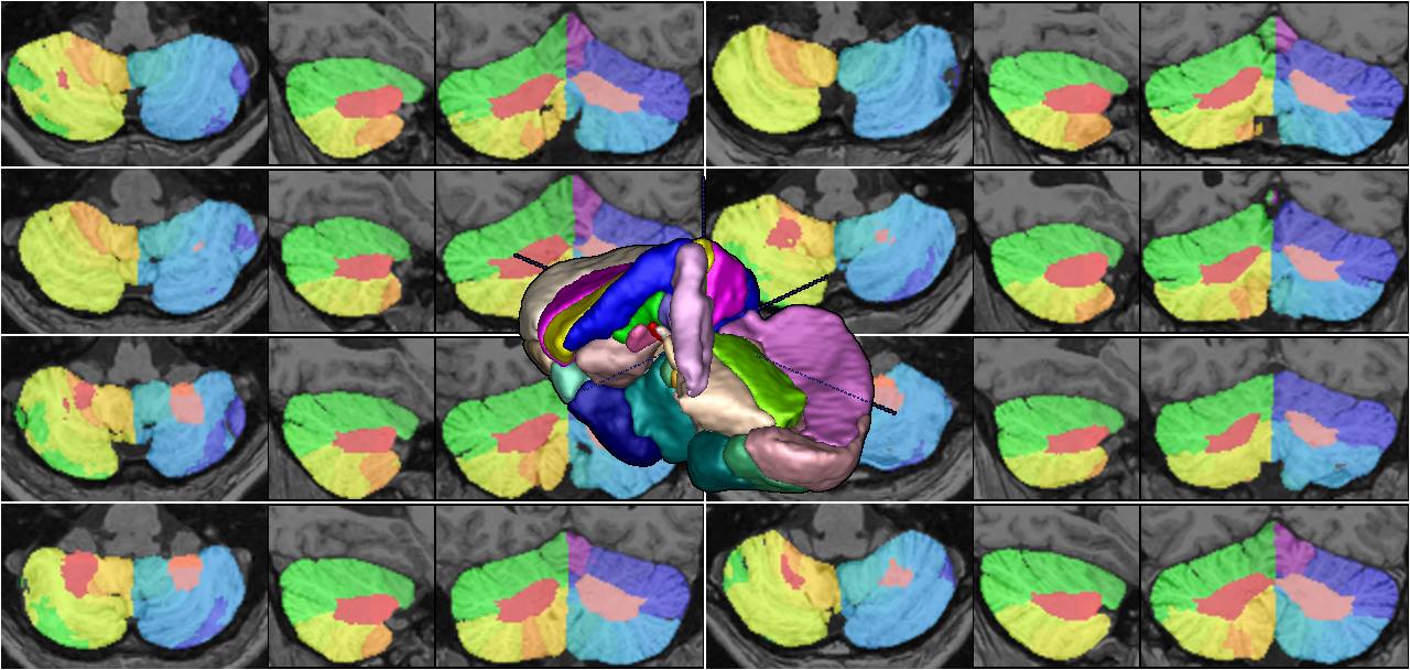 Cerebellum and its lobules segmentation – NIST